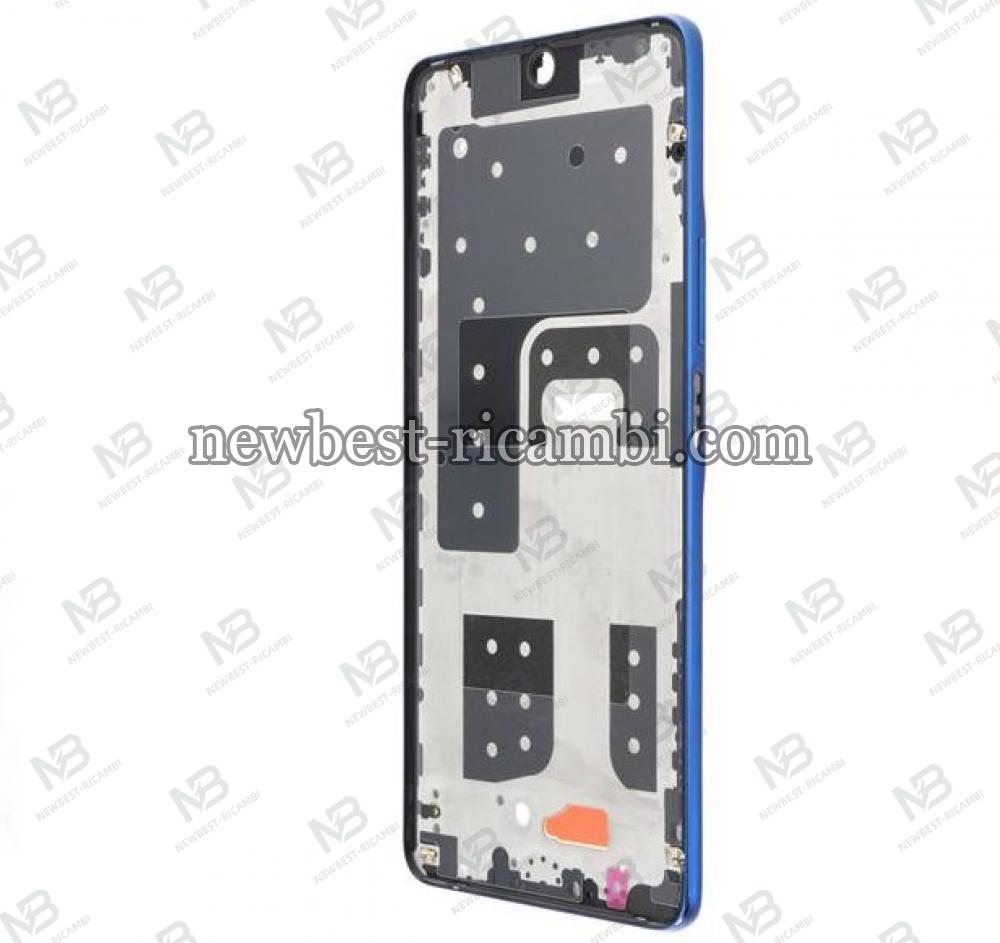 Huawei Honor Magic 4 Lite 4G Frame B + Side Key Blue